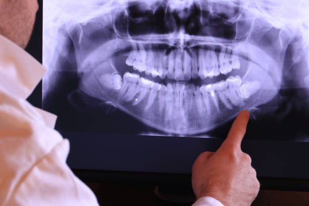 Best Emergency Treatment for Toothache in Terra Alta, WV
