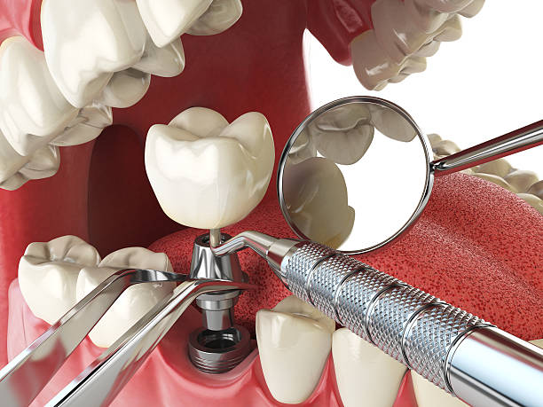 Best Emergency Broken Tooth Repair in Terra Alta, WV